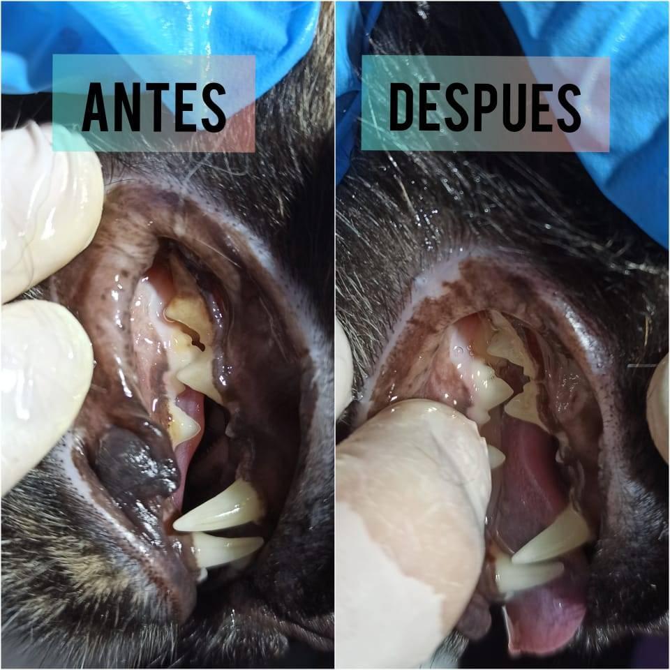 CAMPANA DE LIMPIEZA DENTAL 2