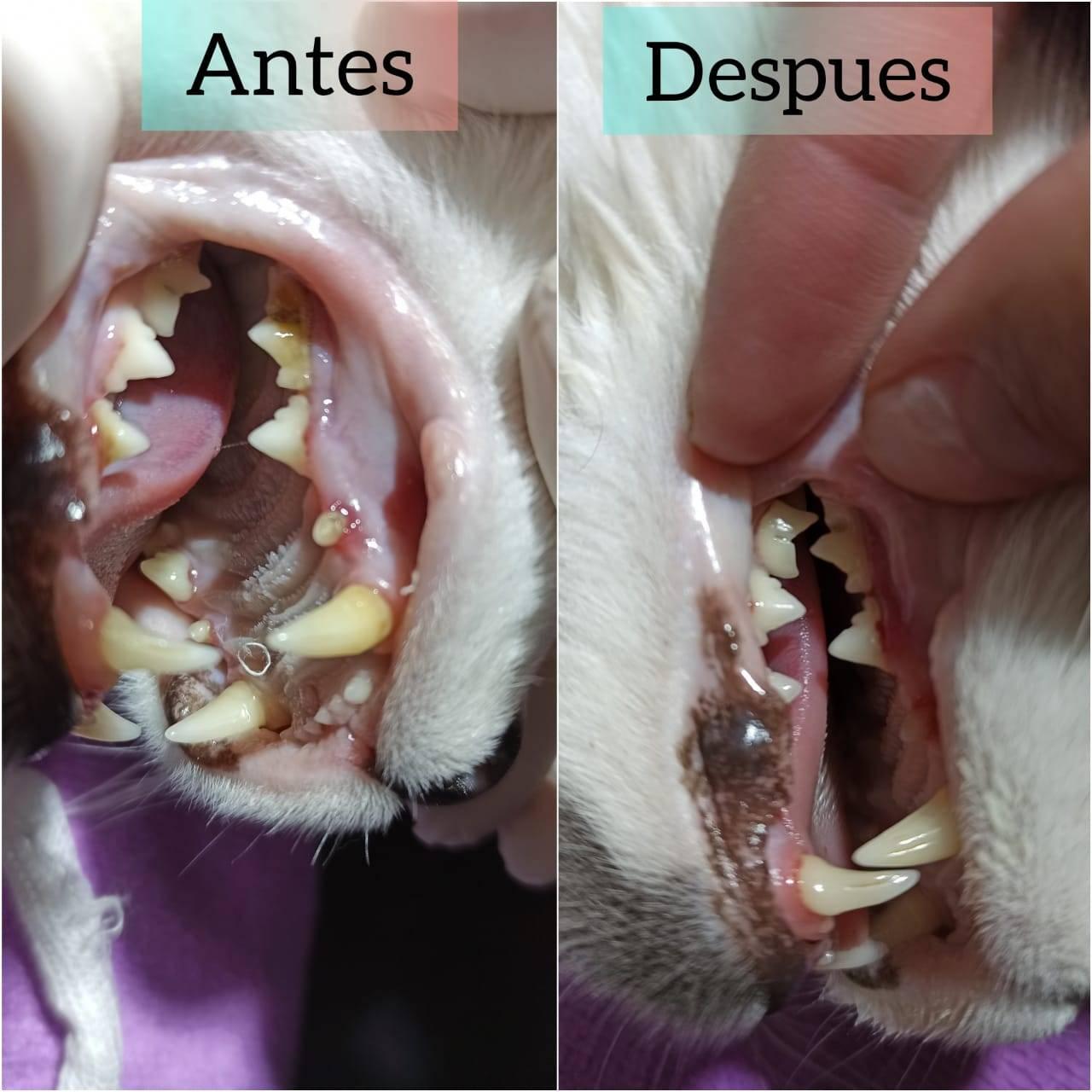CAMPANA DE LIMPIEZA DENTAL 3