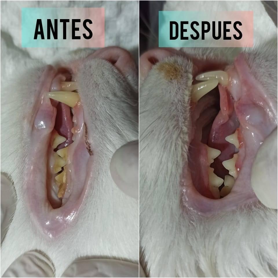 CAMPANA DE LIMPIEZA DENTAL 4