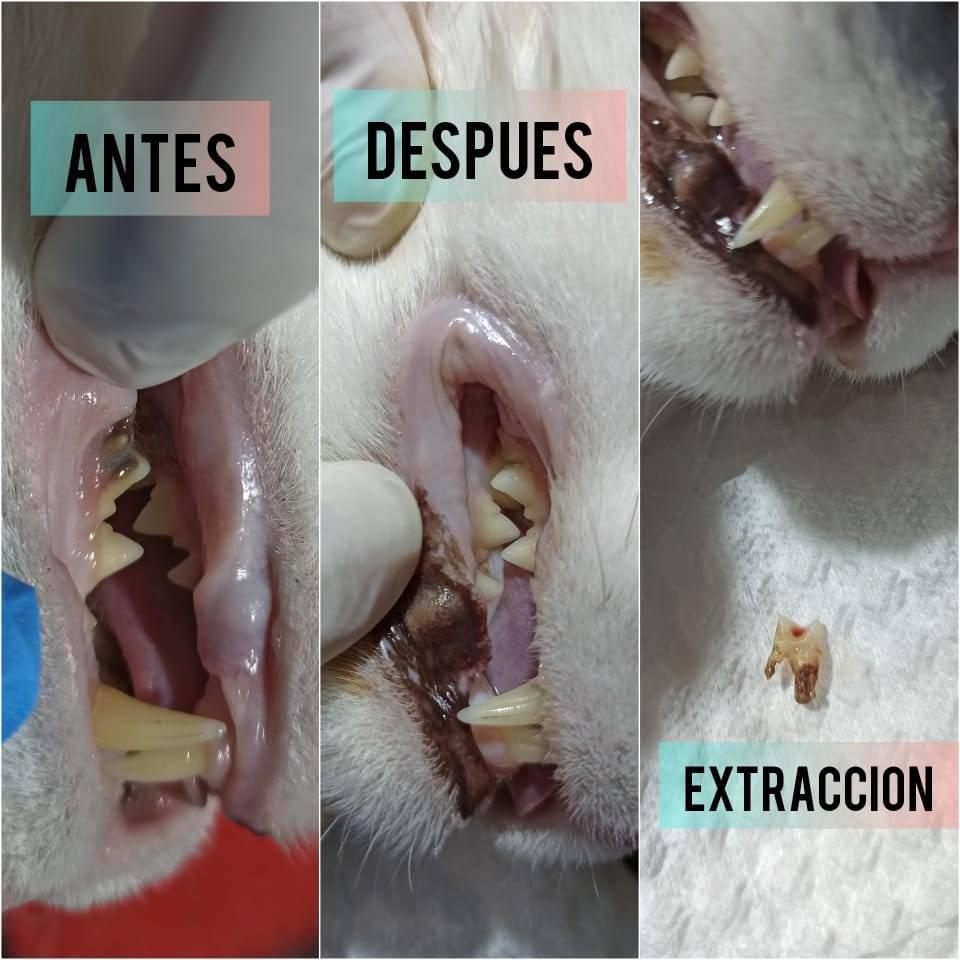 CAMPANA DE LIMPIEZA DENTAL